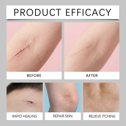 Gentle Formula Advanced Silicone Scar Repair Stick